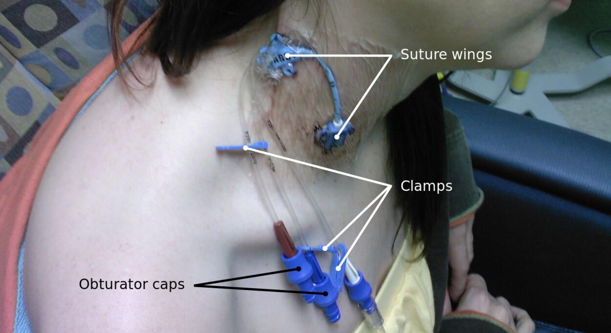 Central & Vascular Access Lines