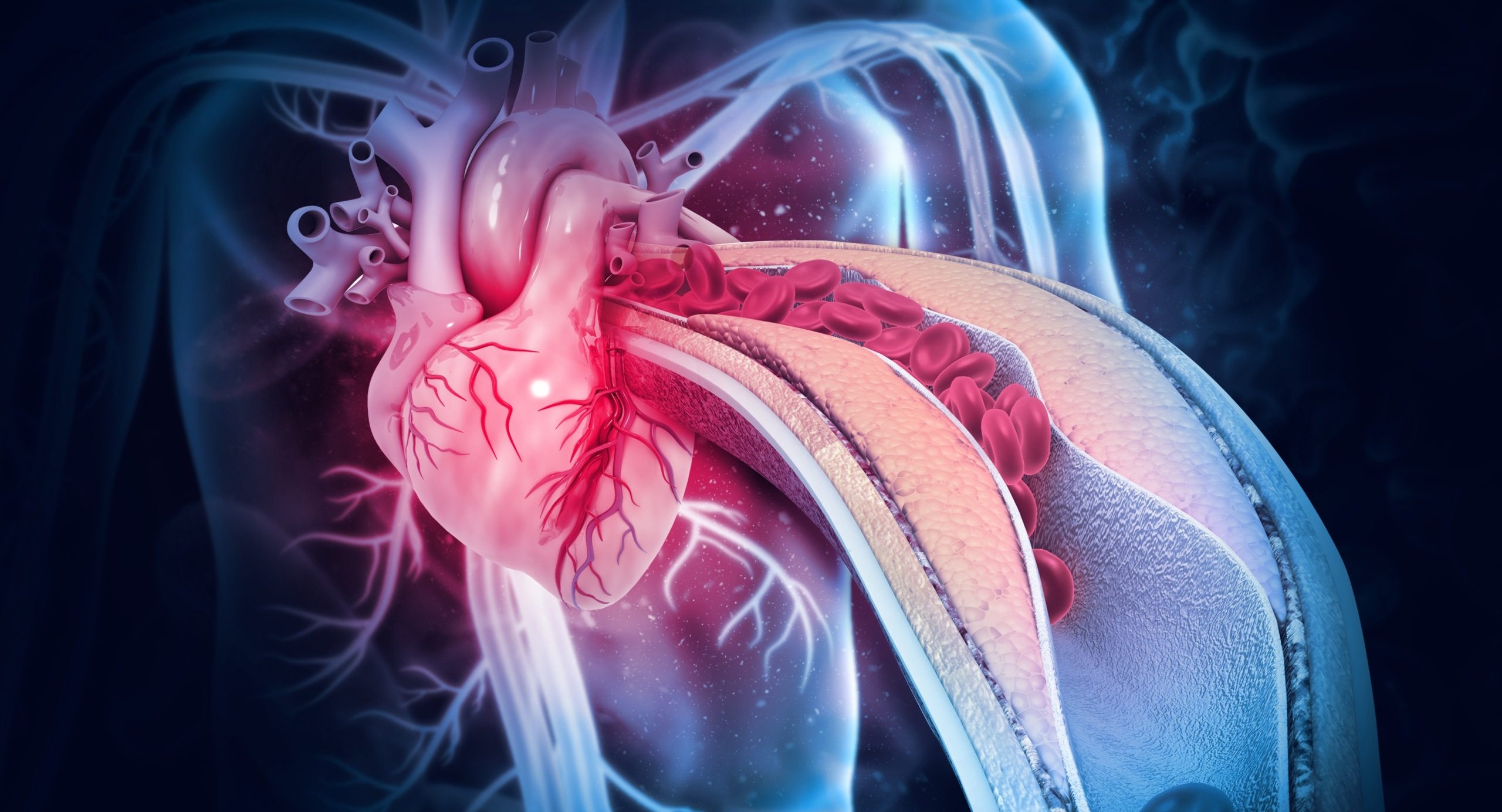Percutaneous Interventions